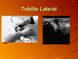 Tobillo LateralTobillo Lateral
 