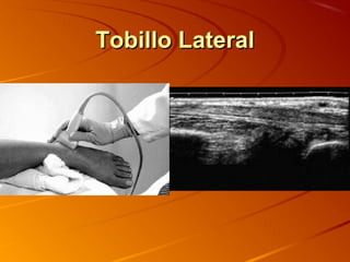Tobillo LateralTobillo Lateral
 