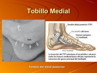 Tobillo MedialTobillo Medial
Tendón del tibial posteriorTendón del tibial posterior
 