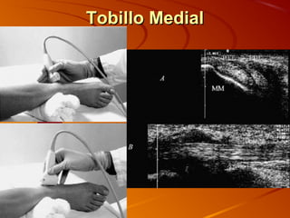 Tobillo MedialTobillo Medial
 