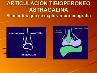 ARTICULACIÓN TIBIOPERONEOARTICULACIÓN TIBIOPERONEO
ASTRAGALINAASTRAGALINA
Elementos que se exploranElementos que se exploran por ecografíapor ecografía
 