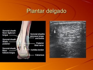 Plantar delgadoPlantar delgado
 