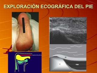 EXPLORACIÓN ECOGRÁFICA DEL PIEEXPLORACIÓN ECOGRÁFICA DEL PIE
 