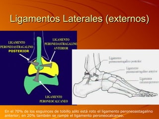 Ligamentos Laterales (externos)Ligamentos Laterales (externos)
POSTERIORPOSTERIOR
En el 70% de los esguinces de tobillo sólo está roto el ligamento peroneoastagalino
anterior; en 20% también se rompe el ligamento peroneocalcaneo.
 