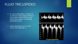 FLUJO TRICUSPIDEO
 EL FLUJO SANGUÍNEO A TRAVÉS DE
LA VÁLVULA TRICUSPIDEA PRODUCE
UNA ONDA CARACTERÍSTICA QUE
PUEDE SER NORMAL O ANORMAL
(REGURGITACIÓN).
 ONDA ANORMAL EN EL 55% DE
FETOS CON TRISOMÍA 21
 