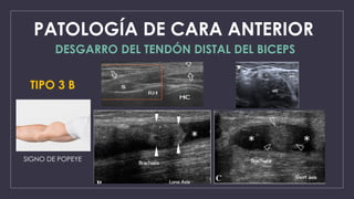 Ecograf a Musculoesquel tica Codo Tecnica Y Protocolopptx PPTX ecograf-a-musculoesquel-tica-codo-tecnica-y-protocolopptx-pptx