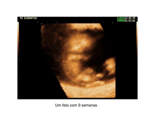 Um feto com 9 semanas   