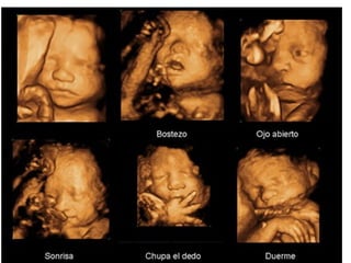 ecografia.ppt...........................