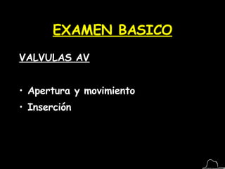 EXAMEN BASICO VALVULAS AV Apertura y movimiento Inserción 