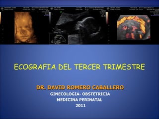 ECOGRAFIA DEL TERCER TRIMESTRE   DR. DAVID ROMERO CABALLERO GINECOLOGIA- OBSTETRICIA MEDICINA PERINATAL  2011 