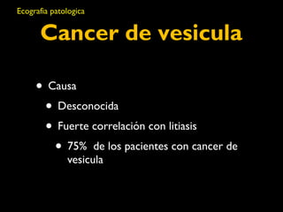 Ecografia patologica 
Cancer de vesicula 
• Causa 
• Desconocida 
• Fuerte correlación con litiasis 
• 75% de los pacientes con cancer de 
vesicula 
 