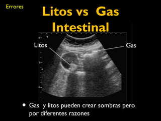 Litos vs Gas 
Intestinal 
Errores 
Litos Gas 
• Gas y litos pueden crear sombras pero 
por diferentes razones 
 