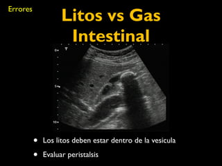 Litos vs Gas 
Intestinal 
• Los litos deben estar dentro de la vesicula 
• Evaluar peristalsis 
Errores 
 