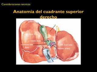 Anatomia del cuadrante superior 
derecho 
Consideraciones tecnicas 
right liver lobe 
quadrate 
liver lobe 
left liver lobe 
IVC 
gallbladder 
cystic duct 
portal vein 
hepatic artery 
common bile 
duct 
 