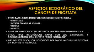 ASPECTOS ECOGRÁFICO DEL 
CÁNCER DE PRÓSTATA 
• OTRAS PATOLOGIAS TMBN PUEDE DAR LESIONES HIPOECOICA: 
HIPERPLASIA 
ECTASIA GLANDULAR BENINGA. 
FIBROSIS 
QUISTES. 
• PUEDE SER HIPERECOICO SECUNDARIOA UNA RESPUESTA DESMOPLASTICA. 
• OTROS TIPOS HISTOLÓGICOS RAROS SON LOS CRIBIFORMES Y 
COMEDONECROSIS CON ASPECTO “CIELO ESTRELLADO” 
• MAS DEL 30% DE CA SON ISOECOICOS POR TANTO IMPOSIBLE DE DETECTAR 
SIN BIOPSIAS SISTEMÁTICAS. 
 