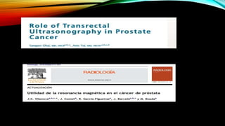 Ecografia cancer prostata