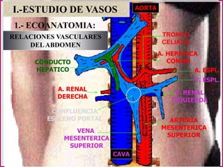 I.-ESTUDIO DE VASOS AORTA
CONDUCTO
HEPATICO
A. RENAL
DERECHA
VENA
MESENTERICA
SUPERIOR
CAVA
V. RENAL
IZQUIERDA
V. ESPL.
A. ESPL.
A. HEPATICA
COMUN
CONFLUENCIA
ESPLENO PORTAL
TRONCO
CELIACO
ARTERIA
MESENTERICA
SUPERIOR
RELACIONES VASCULARES
DELABDOMEN
1.- ECOANATOMIA:
 