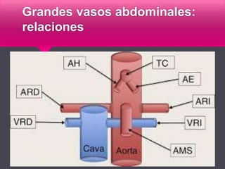 Grandes vasos abdominales:
relaciones
 