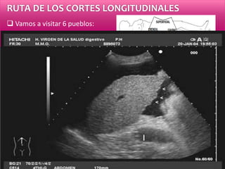 RUTA DE LOS CORTES LONGITUDINALES
 Vamos a visitar 6 pueblos:
1.- LHI
 Ángulo
 Bordes
 Estructura
 