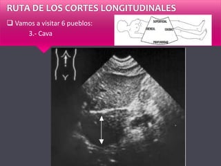 RUTA DE LOS CORTES LONGITUDINALES
 Vamos a visitar 6 pueblos:
3.- Cava
 