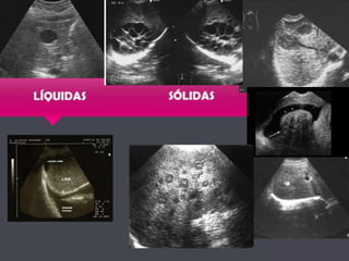 De qué nos acordamos…???
 