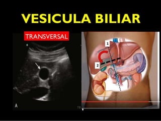 RUTA DE LOS CORTES LONGITUDINALES
 Vamos a visitar 6 pueblos:
5.- Vesícula
 