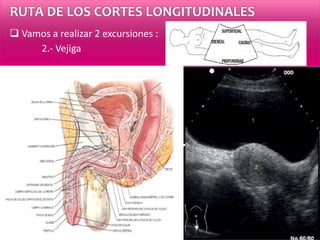 RUTA DE LOS CORTES LONGITUDINALES
 Vamos a realizar 2 excursiones :
2.- Vejiga
 