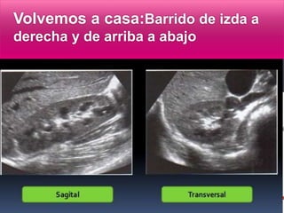 Volvemos a casa:Barrido de izda a
derecha y de arriba a abajo
 