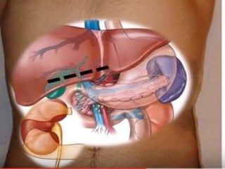 ANATOMÍA CORTES TRANSVERSALES
 