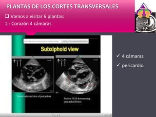 PLANTAS DE LOS CORTES TRANSVERSALES
 Vamos a visitar 6 plantas:
1.- Corazón 4 cámaras
 4 cámaras
 pericardio
 