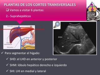 PLANTAS DE LOS CORTES TRANSVERSALES
 Vamos a visitar 6 plantas:
2.- Suprahepáticas
 Para segmentar el hígado:
 SHD: el LHD en anterior y posterior
 SHM: lóbulo hepático derecho e izquierdo
 SHI: LHI en medial y lateral
 