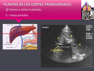PLANTAS DE LOS CORTES TRANSVERSALES
 Vamos a visitar 6 plantas:
3.- Vasos portales
 