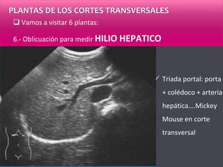 PLANTAS DE LOS CORTES TRANSVERSALES
 Vamos a visitar 6 plantas:
6.- Oblicuación para medir HILIO HEPATICO
 Triada portal: porta
+ colédoco + arteria
hepática….Mickey
Mouse en corte
transversal
 