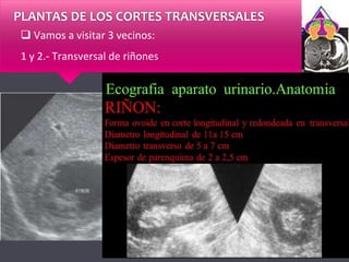 PLANTAS DE LOS CORTES TRANSVERSALES
 Vamos a visitar 3 vecinos:
1 y 2.- Transversal de riñones
 