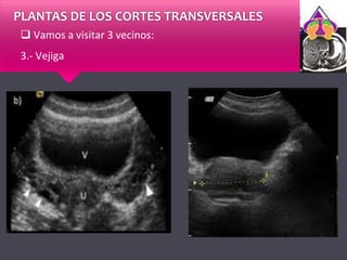 PLANTAS DE LOS CORTES TRANSVERSALES
 Vamos a visitar 3 vecinos:
3.- Vejiga
 