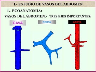 CAVA PORTA AORTA
I.- ESTUDIO DE VASOS DELABDOMEN
VASOS DELABDOMEN.- TRES EJES IMPORTANTES:
1.- ECOANATOMIA:
 