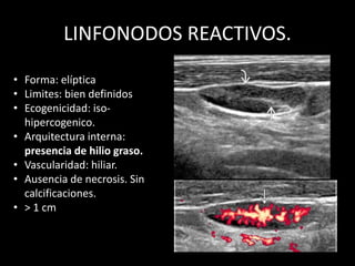 LINFONODOS REACTIVOS.
• Forma: elíptica
• Limites: bien definidos
• Ecogenicidad: iso-
hipercogenico.
• Arquitectura interna:
presencia de hilio graso.
• Vascularidad: hiliar.
• Ausencia de necrosis. Sin
calcificaciones.
• > 1 cm
 