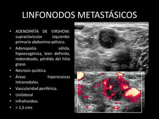 LINFONODOS METASTÁSICOS
• ADENOPATÍA DE VIRSHOW:
supraclavicular izquierdo:
primario abdomino-pélvico.
• Adenopatía sólida,
hipoecogénica, bien definida,
redondeado, pérdida del hilio
graso.
• Necrosis quística.
• Áreas hiperecoicas
intranodales.
• Vascularidad periférica.
• Unilateral
• Infrahioideo.
• > 1,5 cms
 