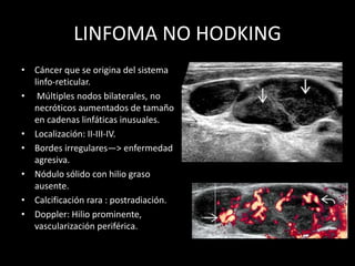 LINFOMA NO HODKING
• Cáncer que se origina del sistema
linfo-reticular.
• Múltiples nodos bilaterales, no
necróticos aumentados de tamaño
en cadenas linfáticas inusuales.
• Localización: II-III-IV.
• Bordes irregulares—> enfermedad
agresiva.
• Nódulo sólido con hilio graso
ausente.
• Calcificación rara : postradiación.
• Doppler: Hilio prominente,
vascularización periférica.
 