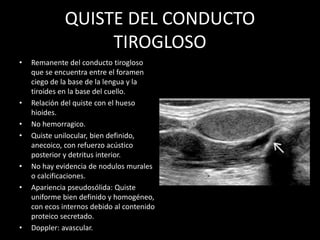 QUISTE DEL CONDUCTO
TIROGLOSO
• Remanente del conducto tirogloso
que se encuentra entre el foramen
ciego de la base de la lengua y la
tiroides en la base del cuello.
• Relación del quiste con el hueso
hioides.
• No hemorragico.
• Quiste unilocular, bien definido,
anecoico, con refuerzo acústico
posterior y detritus interior.
• No hay evidencia de nodulos murales
o calcificaciones.
• Apariencia pseudosólida: Quiste
uniforme bien definido y homogéneo,
con ecos internos debido al contenido
proteico secretado.
• Doppler: avascular.
 
