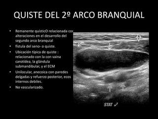 QUISTE DEL 2º ARCO BRANQUIAL
• Remanente quísticO relacionada con
alteraciones en el desarrollo del
segundo arco branquial
• fístula del seno- o quiste.
• Ubicación típica de quiste :
relacionado con la con vaina
carotídea, la glándula
submandibular, y el ECM
• Unilocular, anecoica con paredes
delgadas y refuerzo posterior, ecos
internos debiles.
• No vascularizado.
 