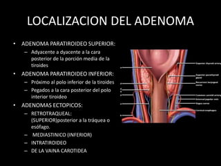 LOCALIZACION DEL ADENOMA
• ADENOMA PARATIROIDEO SUPERIOR:
– Adyacente a dyacente a la cara
posterior de la porción media de la
tiroides
• ADENOMA PARATIROIDEO INFERIOR:
– Próximo al polo inferior de la tiroides
– Pegados a la cara posterior del polo
interior tiroideo
• ADENOMAS ECTOPICOS:
– RETROTRAQUEAL:
(SUPERIOR)posterior a la tráquea o
esófago.
– MEDIASTINICO (INFERIOR)
– INTRATIROIDEO
– DE LA VAINA CAROTIDEA
 