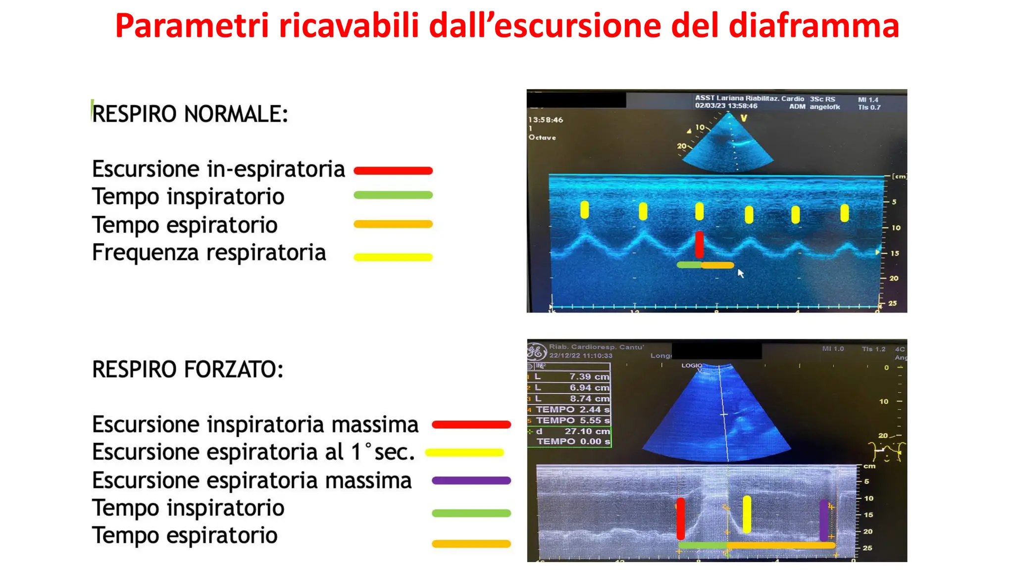 Membrane De Chaudière FAGOR MU0886400 - Foto 11
