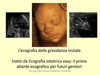 L’ecografia della gravidanza iniziale
tratto da Ecografia ostetrica easy: il primo
atlante ecografico per futuri genitori
Dr.ssa Valentina-Violante Pontello
 
