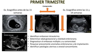 Ecografia del Primer Trimestre PPT