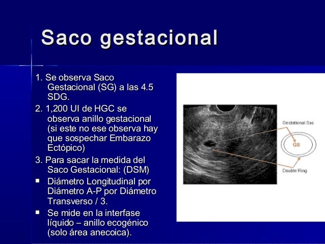 4 semanas de embarazo cuanto mide el saco 4 semanas de embarazo cuanto mide el saco