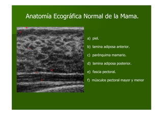a) piel.
b) lamina adiposa anterior.
c) parénquima mamario.
d) lamina adiposa posterior.
e) fascia pectoral.
f) músculos pectoral mayor y menor
Anatomía Ecográfica Normal de la Mama.
 