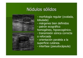 NNóódulos sdulos sóólidoslidos
- morfología regular (ovalada,
lobulada)
- márgenes bien definidos
- patrón ecográfico
homogéneo, hipoecogénico.
- transmisión sónica correcta
o reforzada
- orientación paralela a la
superficie cutánea.
- interfase (pseudocápsula)
 