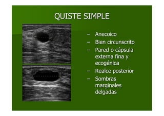 QUISTE SIMPLEQUISTE SIMPLE
–– AnecoicoAnecoico
–– Bien circunscritoBien circunscrito
–– Pared o cPared o cáápsulapsula
externa fina yexterna fina y
ecogecogéénicanica
–– Realce posteriorRealce posterior
–– SombrasSombras
marginalesmarginales
delgadasdelgadas
 