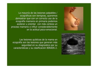 La mayorLa mayoríía de las lesiones palpables /a de las lesiones palpables /
ecogrecográáficas son benignas, queremosficas son benignas, queremos
demostrar que con un correcto uso de lademostrar que con un correcto uso de la
ecografecografíía mamaria en primaria podemosa mamaria en primaria podemos
acelerar u orientar con macelerar u orientar con máás certeza uns certeza un
proceso mamario e influir considerablementeproceso mamario e influir considerablemente
en la actitud psicoen la actitud psico--emocional.emocional.
Las lesiones quLas lesiones quíísticas de la mama ensticas de la mama en
ecografecografíía son las lesiones que generan ma son las lesiones que generan mááss
seguridad en su diagnostico por suseguridad en su diagnostico por su
caractercaracteríísticas y su clasificacisticas y su clasificacióón BIRADS 2.n BIRADS 2.
 